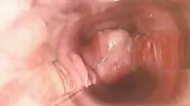 Sexy xoa phim set nh ...
